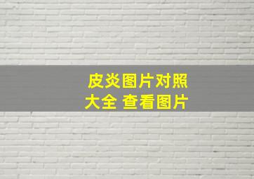 皮炎图片对照大全 查看图片